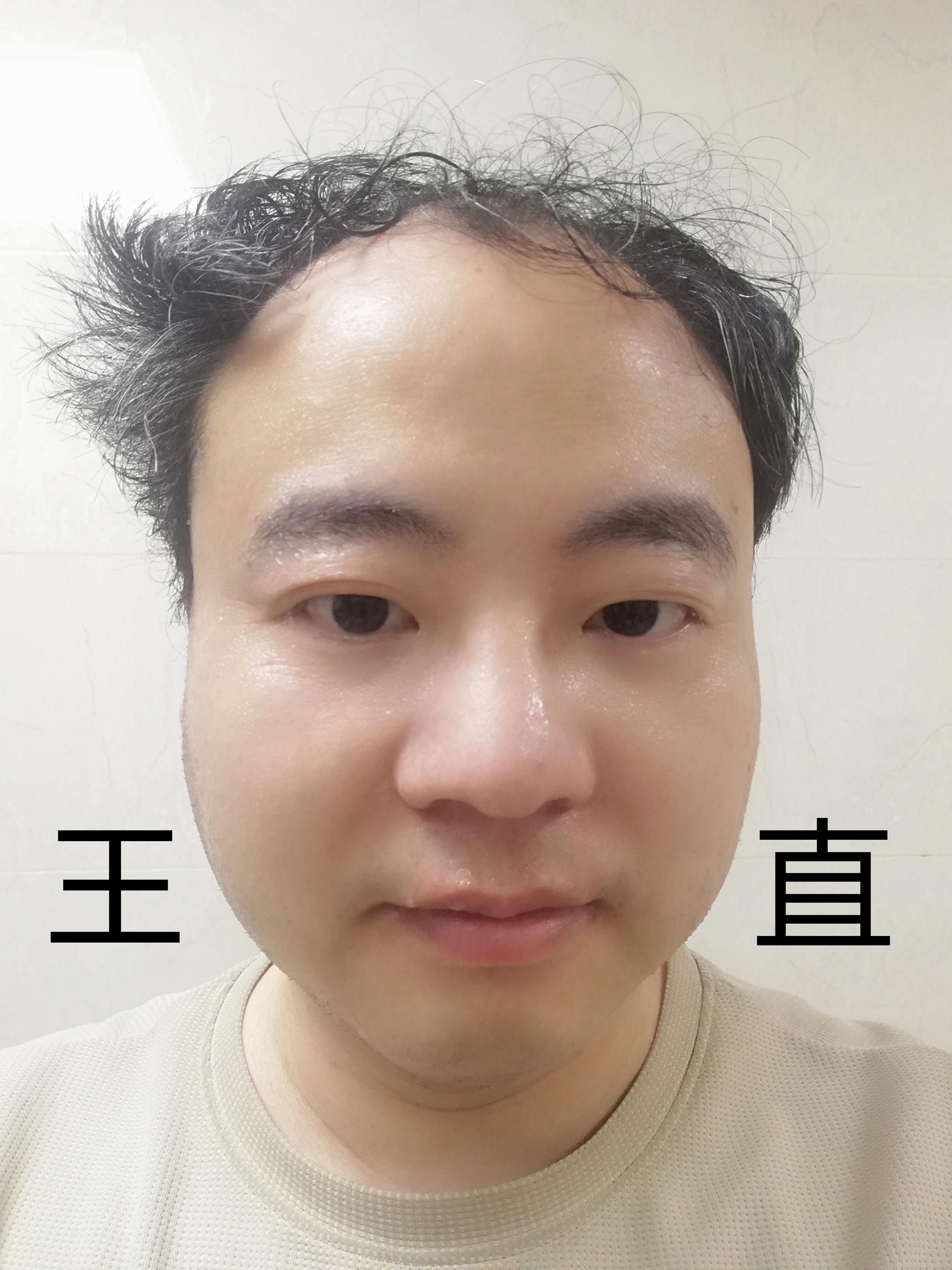 王直哲